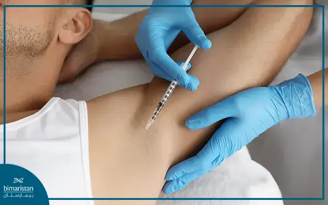Treatment Of Excessive Underarm Sweating Through Botox Injections