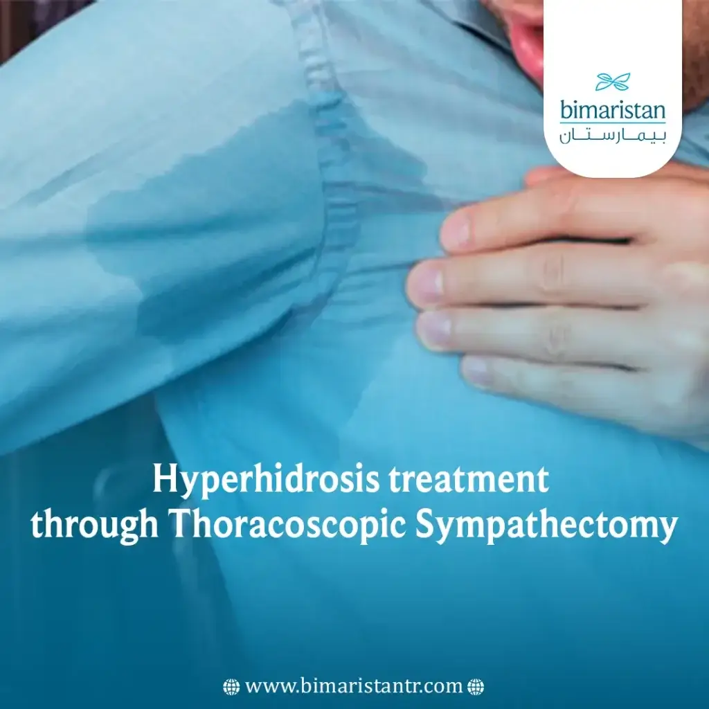 Thoracoscopic Sympathectomy | Permanent Hyperhidrosis Treatment