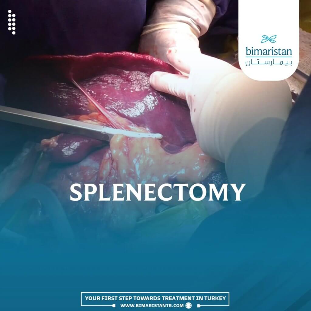 Splenectomy Procedure: Causes &Amp; Risks