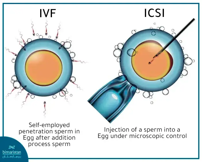 Difference Between Ivf And Icsi