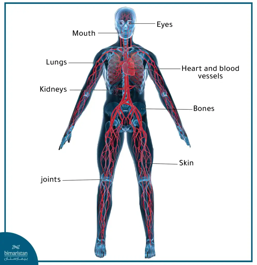 Tissues And Organs That May Exhibit Symptoms Of Rheumatoid Arthritis