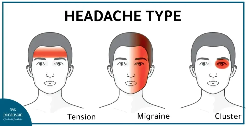 Types Of Headache Pain